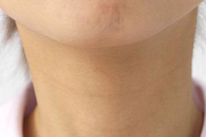 小児矯正治療の選び方と早良区で人気の歯科医院を紹介！