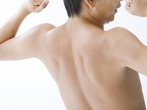 レーザー治療によるイボの除去について