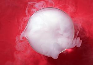 受け口の見た目を治したい方は審美歯科へ